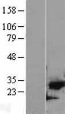 Western Blot: Cdk5 Overexpression Lysate [NBL1-09040]