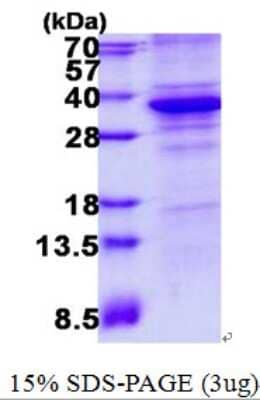 SDS-PAGE: Recombinant Human Cdk5 His Protein [NBP2-22975]