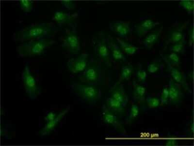 Immunocytochemistry/ Immunofluorescence: Cdk6 Antibody (8H4) [H00001021-M01]