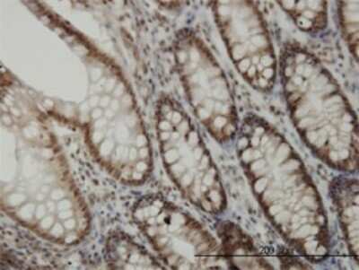 Immunohistochemistry-Paraffin: Cdk6 Antibody (8H4) [H00001021-M01]