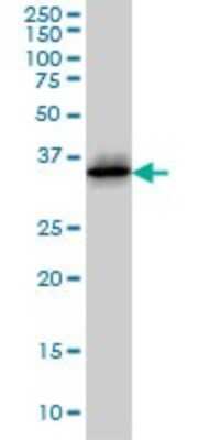 Western Blot: Cdk6 Antibody (8H4) [H00001021-M01]