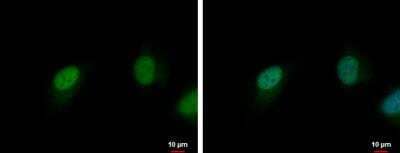 Immunocytochemistry/ Immunofluorescence: Cdk6 Antibody [NBP2-15846]