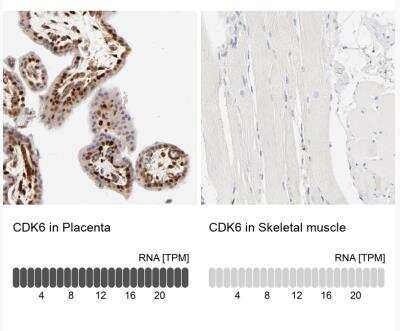 Immunohistochemistry-Paraffin: Cdk6 Antibody [NBP1-87262]