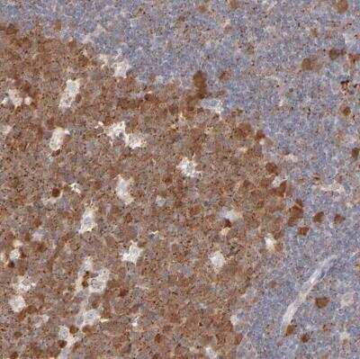 Immunohistochemistry-Paraffin: Cdk6 Antibody [NBP1-87262]
