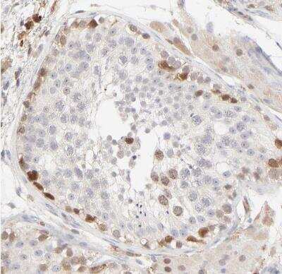 Immunohistochemistry-Paraffin: Cdk6 Antibody [NBP1-87262]