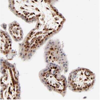 Immunohistochemistry-Paraffin: Cdk6 Antibody [NBP1-87262]
