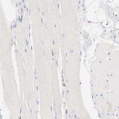 Immunohistochemistry-Paraffin: Cdk6 Antibody [NBP1-87262]