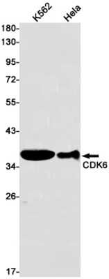 Western Blot: Cdk6 Antibody (S03-2G5) [NBP3-14918]