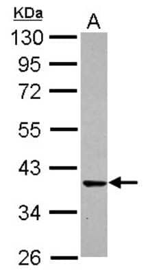 Western Blot: Cdk6 Antibody [NBP2-15846]