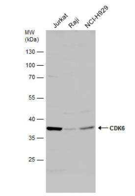 Western Blot: Cdk6 Antibody [NBP2-15846]