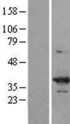 Western Blot: Cdk6 Overexpression Lysate [NBL1-09044]