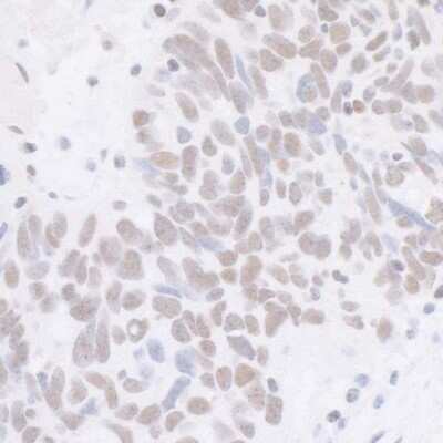 Immunohistochemistry: Cdk7 Antibody (BL-80-5D4) [NBP2-76409]