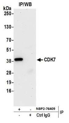 Immunoprecipitation: Cdk7 Antibody (BL-80-5D4) [NBP2-76409]