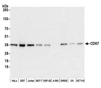 Western Blot: Cdk7 Antibody (BL-80-5D4) [NBP2-76409]