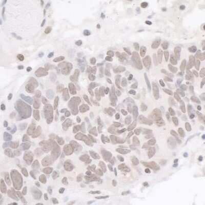 Immunohistochemistry: Cdk7 Antibody [NB100-581]