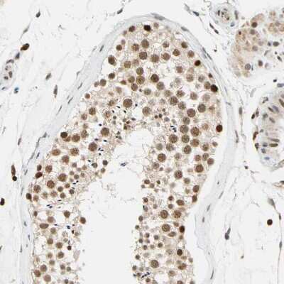 Immunohistochemistry-Paraffin: Cdk7 Antibody [NBP1-86666]