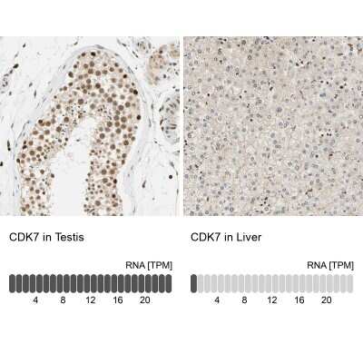 Immunohistochemistry-Paraffin: Cdk7 Antibody [NBP1-86666]
