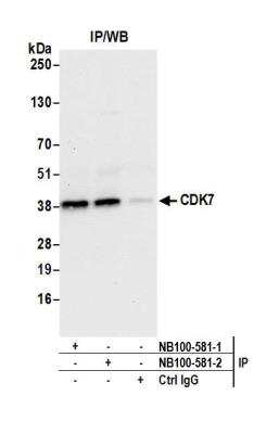 Immunoprecipitation: Cdk7 Antibody [NB100-581]
