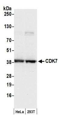 Western Blot: Cdk7 Antibody [NB100-581]