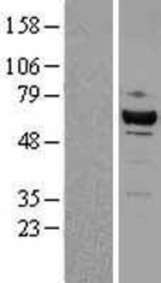 Western Blot: CDK8 Overexpression Lysate [NBL1-09046]