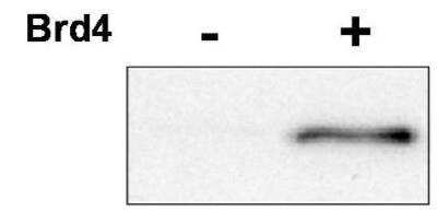 Western Blot: Cdk9 [p Thr29] Antibody [NBP1-77756]