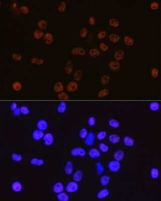 Immunocytochemistry/ Immunofluorescence: Cdk9 Antibody (1C4E3) [NBP3-15345]