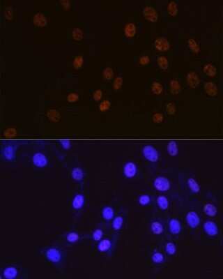 Immunocytochemistry/ Immunofluorescence: Cdk9 Antibody (1C4E3) [NBP3-15345]