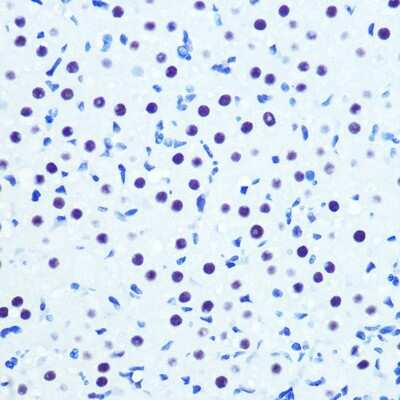 Immunohistochemistry-Paraffin: Cdk9 Antibody (1C4E3) [NBP3-15345]
