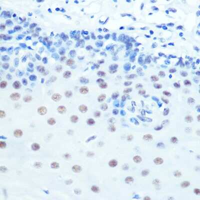 Immunohistochemistry-Paraffin: Cdk9 Antibody (1C4E3) [NBP3-15345]