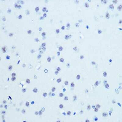 Immunohistochemistry-Paraffin: Cdk9 Antibody (1C4E3) [NBP3-15345]