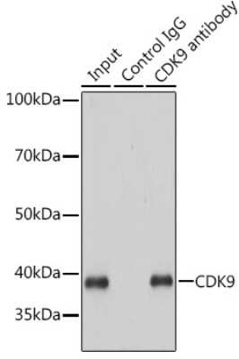 Immunoprecipitation: Cdk9 Antibody (1C4E3) [NBP3-15345]