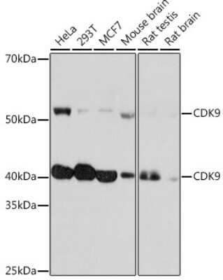 Western Blot: Cdk9 Antibody (1C4E3) [NBP3-15345]