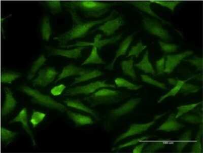 Immunocytochemistry/ Immunofluorescence: Cdk9 Antibody (2D7) [H00001025-M07]