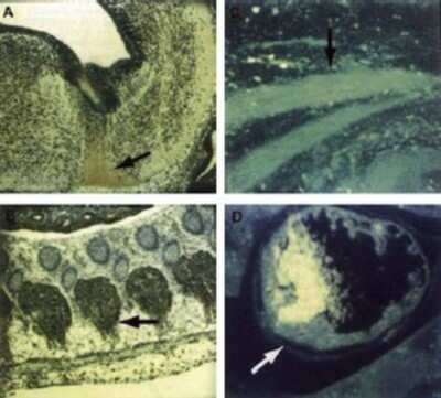 Immunocytochemistry/ Immunofluorescence: Cdk9 Antibody [NB120-10874]