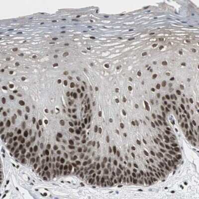 Immunohistochemistry-Paraffin: Cdk9 Antibody [NBP1-86808]