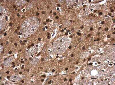 Immunohistochemistry-Paraffin: Cdk9 Antibody [NBP2-15848]