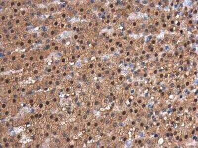 Immunohistochemistry-Paraffin: Cdk9 Antibody [NBP2-15848]