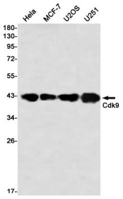 Western Blot: Cdk9 Antibody (S08-4F6) [NBP3-19847]