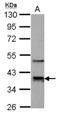 Western Blot: Cdk9 Antibody [NBP2-15848]