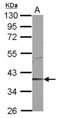 Western Blot: Cdk9 Antibody [NBP2-15848]