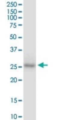 Western Blot: Cdx1 Antibody (2D8) [H00001044-M01]