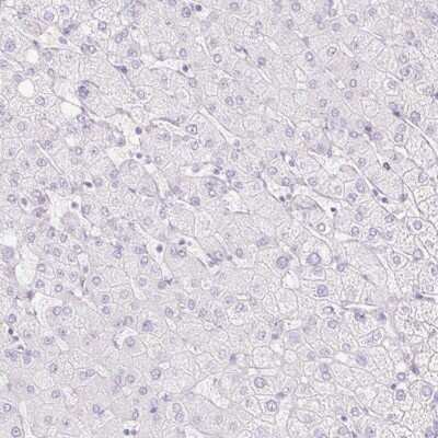 Immunohistochemistry-Paraffin: Cdx1 Antibody [NBP2-49173]