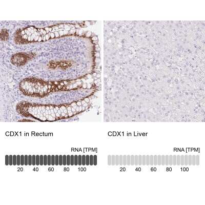 Immunohistochemistry-Paraffin: Cdx1 Antibody [NBP2-49173]