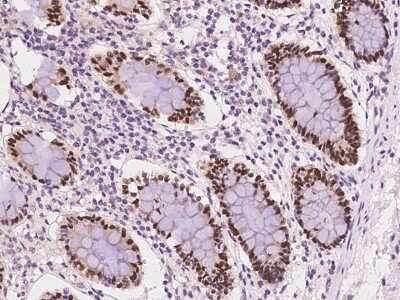 Immunohistochemistry-Paraffin: Cdx1 Antibody [NBP2-98125]