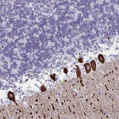 Immunohistochemistry: CDX4 Antibody [NBP2-31643]