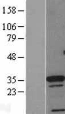 Western Blot: CDX4 Overexpression Lysate [NBL1-09066]