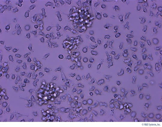 Morphology of Immature Human Dendritic Cells Cultured in Differentiation Media for 7 days.