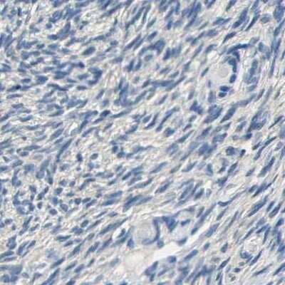 Immunohistochemistry-Paraffin: Centaurin alpha 1 Antibody [NBP1-88098]