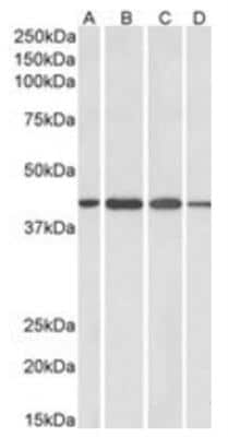 Western Blot: Centaurin alpha 1 Antibody [NB300-907]