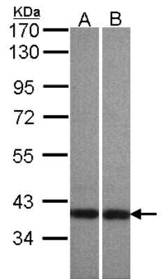 Western Blot: Centaurin alpha 1 Antibody [NBP1-31179]